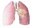 Keeping your lungs healthy during Covid-19